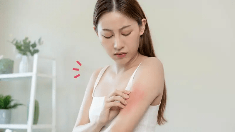 Aturan Pakai Incidal, Obat untuk Mengatasi Reaksi&nbsp;Alergi