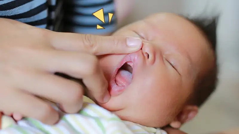 7 Penyebab Bibir Bayi Putih, Bisa Karena Dehidrasi!
