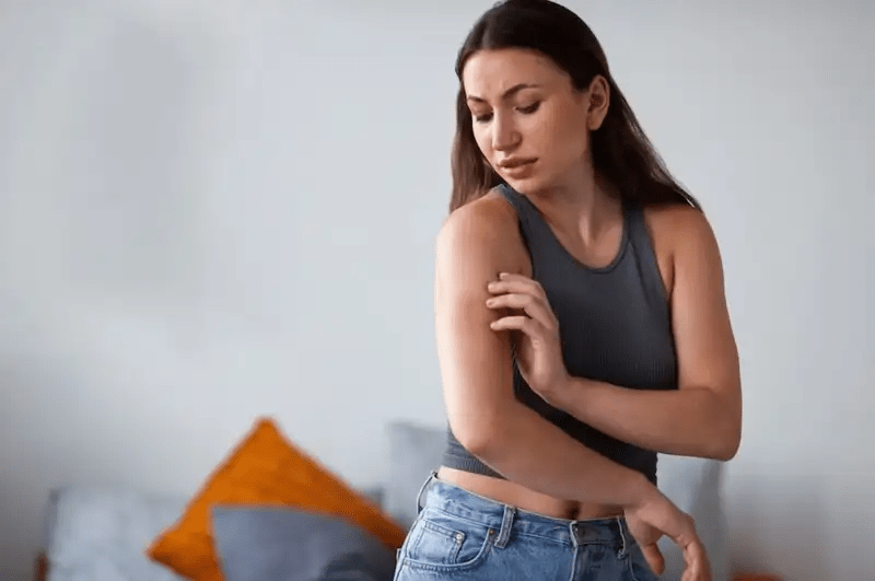 Scabies pada Manusia: Penyebab, Gejala, dan Cara&nbsp;Mengatasi